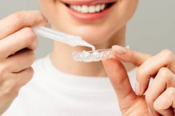 A Comprehensive Guide to Teeth Whitening in Islamabad