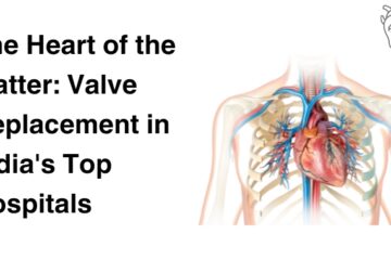 Heart Valve Replacement in India