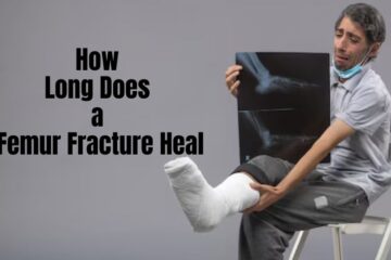 Long Does a Femur Fracture Heal