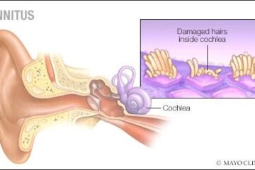 Tinnitus Treatment in Lahore & Pure Tone Audiometry Test Price