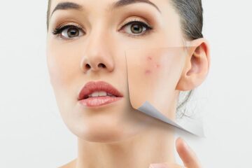 Clear Skin Secrets: How to Remove Pimples Permanently