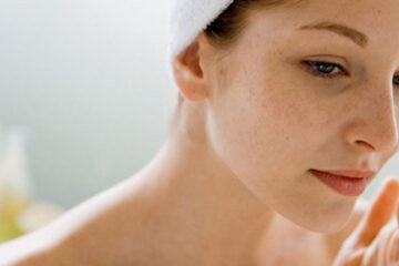 Melasma Treatment Chigwell